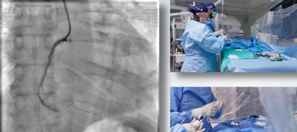 Prednáška pre študentov medicíny: Intervenčná kardiológia pod vedením špičkového odborníka
